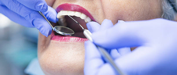 Best Emergency Treatment for Toothache in Balm, FL